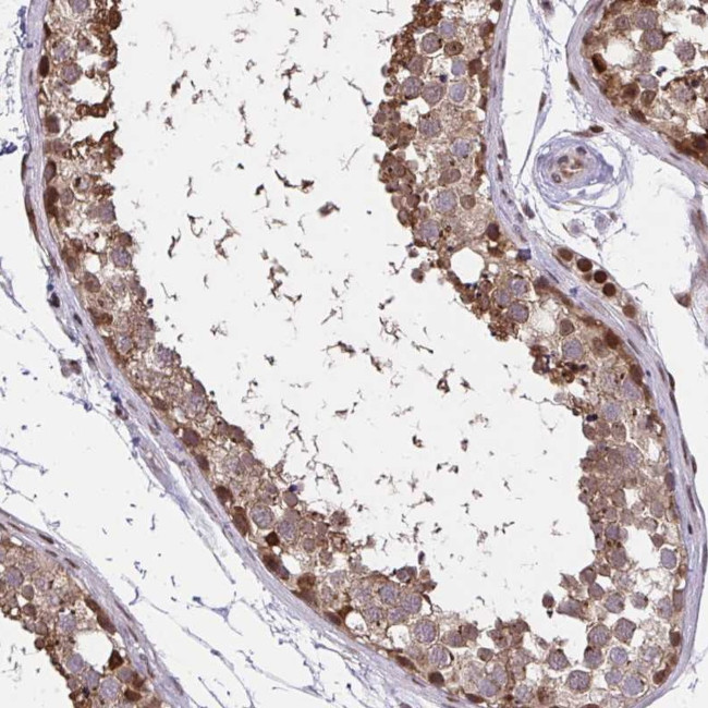 PIGY Antibody in Immunohistochemistry (Paraffin) (IHC (P))