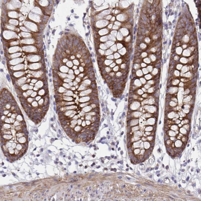 PPIH Antibody in Immunohistochemistry (Paraffin) (IHC (P))