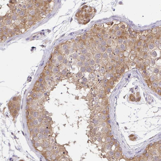 C19orf54 Antibody in Immunohistochemistry (Paraffin) (IHC (P))