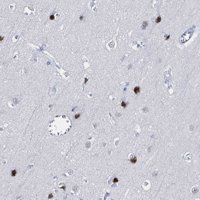 XAGE3 Antibody in Immunohistochemistry (Paraffin) (IHC (P))