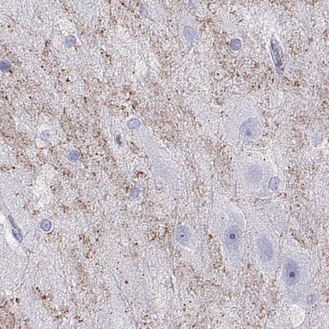 HHLA1 Antibody in Immunohistochemistry (IHC)