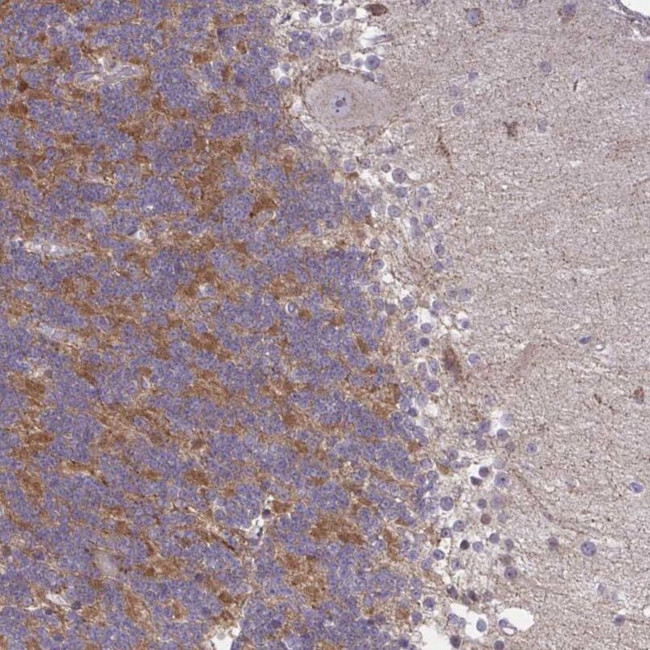 GPRIN3 Antibody in Immunohistochemistry (IHC)