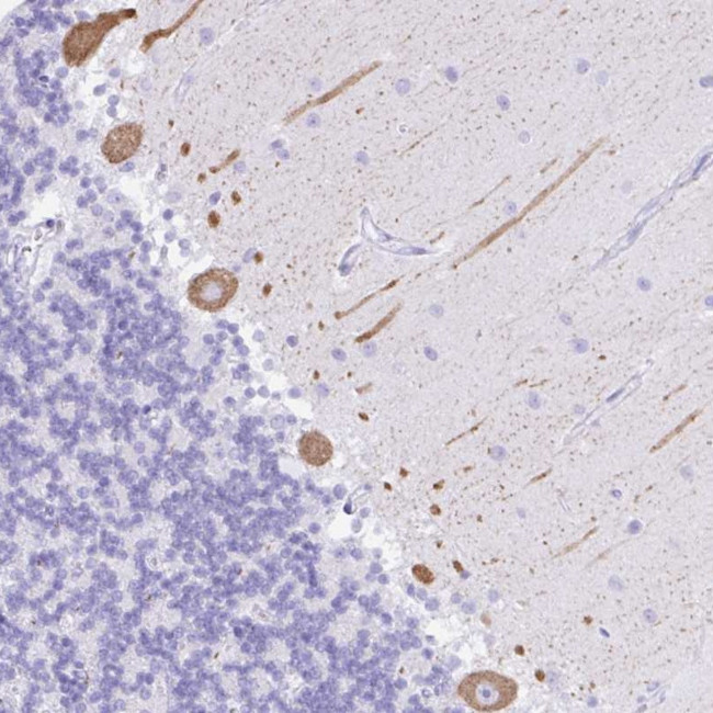SEL1L2 Antibody in Immunohistochemistry (Paraffin) (IHC (P))