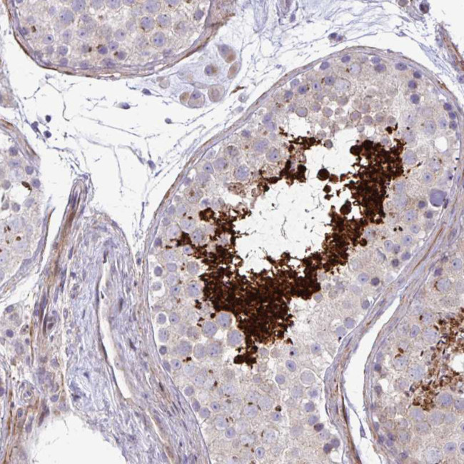 FUNDC2 Antibody in Immunohistochemistry (Paraffin) (IHC (P))