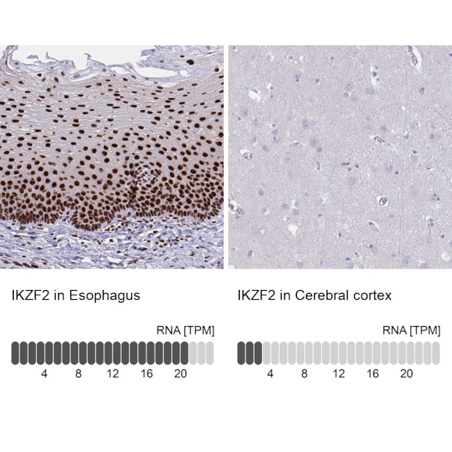 HELIOS Antibody
