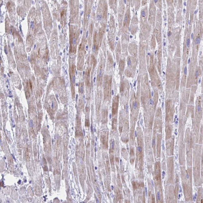 BCL6B Antibody in Immunohistochemistry (Paraffin) (IHC (P))
