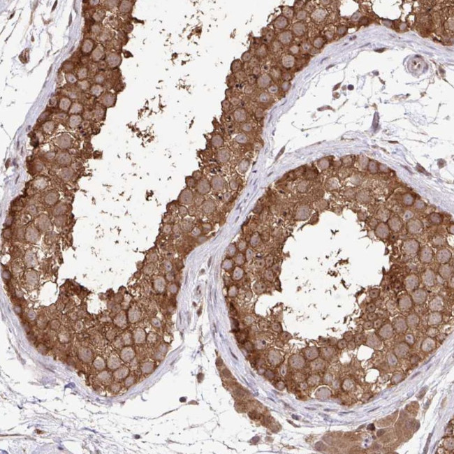 C12orf57 Antibody in Immunohistochemistry (Paraffin) (IHC (P))