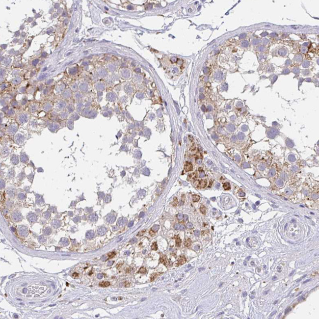 TMEM219 Antibody in Immunohistochemistry (IHC)