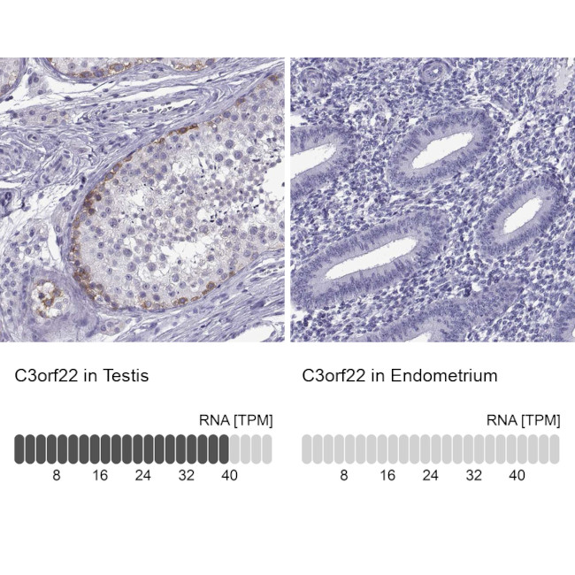 C3orf22 Antibody in Immunohistochemistry (IHC)