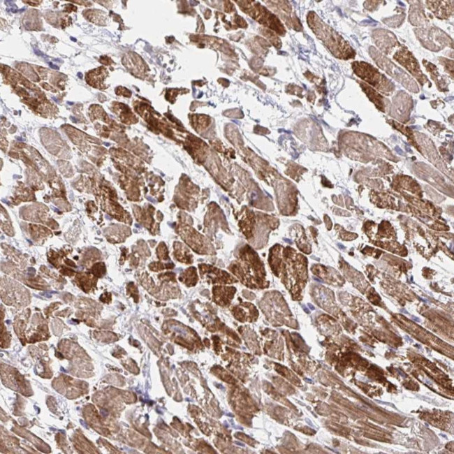 SKA2 Antibody in Immunohistochemistry (Paraffin) (IHC (P))