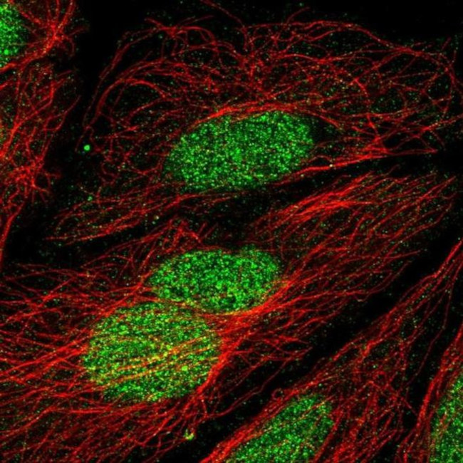 ZNF362 Antibody in Immunocytochemistry (ICC/IF)