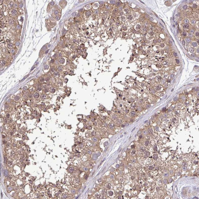 ZNF200 Antibody in Immunohistochemistry (Paraffin) (IHC (P))