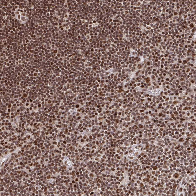 ZDHHC12 Antibody in Immunohistochemistry (Paraffin) (IHC (P))