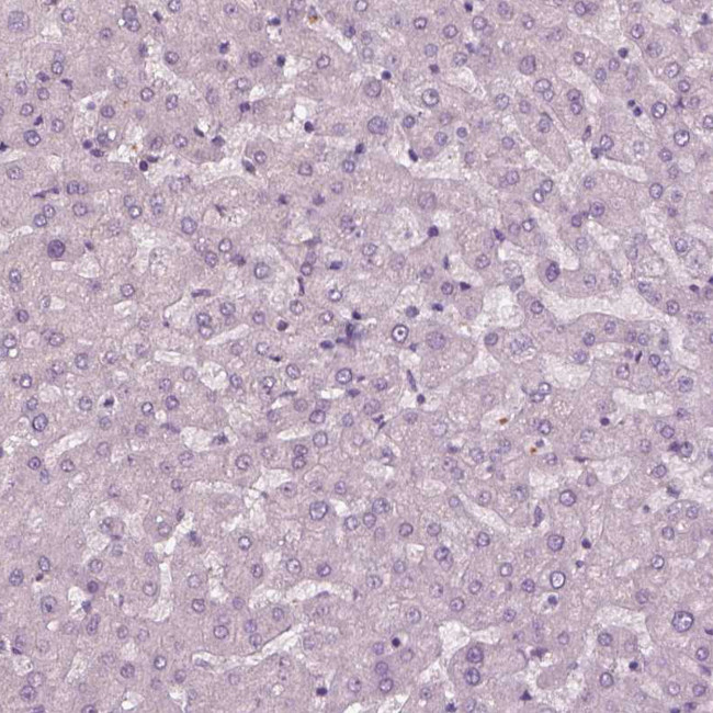 KRT79 Antibody in Immunohistochemistry (Paraffin) (IHC (P))