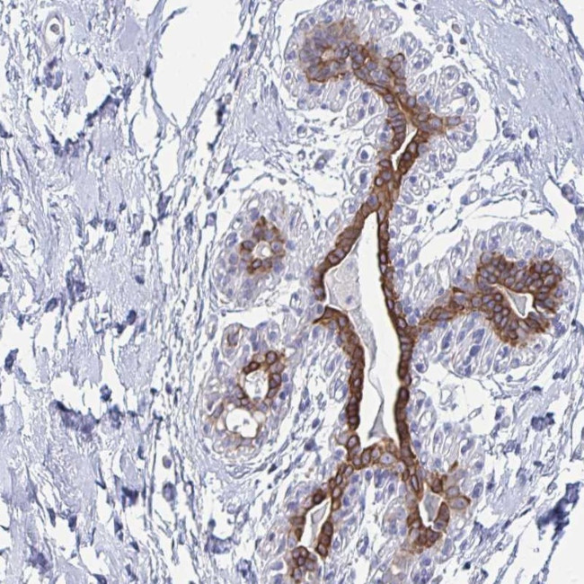 FAM46D Antibody in Immunohistochemistry (Paraffin) (IHC (P))