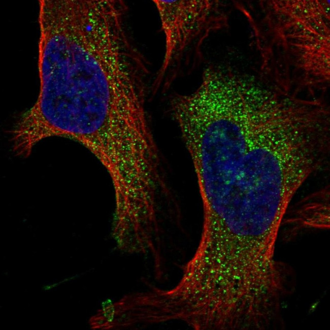 TMEM222 Antibody in Immunocytochemistry (ICC/IF)