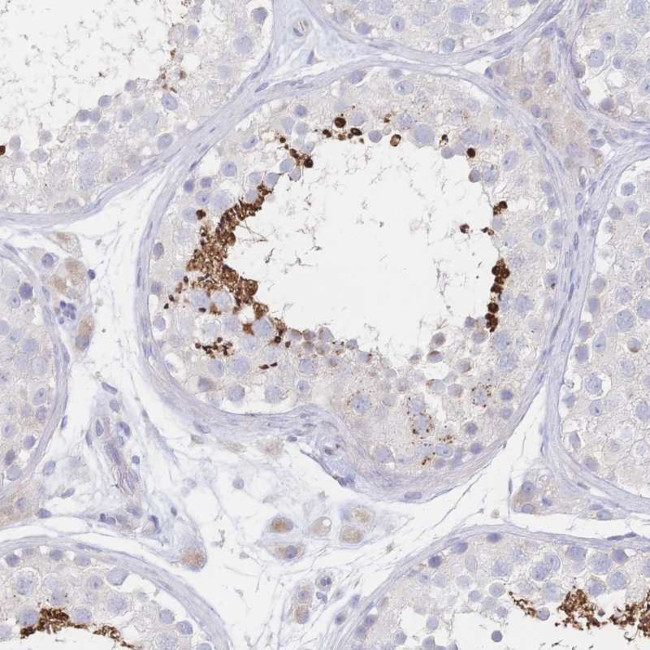 VWC2L Antibody in Immunohistochemistry (Paraffin) (IHC (P))