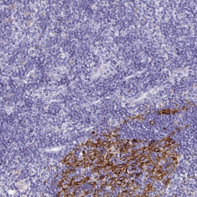 CDCA4 Antibody in Immunohistochemistry (IHC)