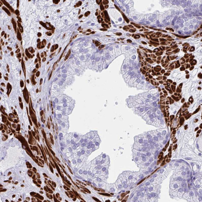 GRXCR2 Antibody in Immunohistochemistry (IHC)