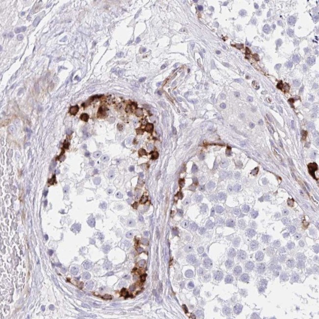 ZNF713 Antibody in Immunohistochemistry (Paraffin) (IHC (P))