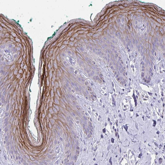 GSG1L2 Antibody in Immunohistochemistry (Paraffin) (IHC (P))