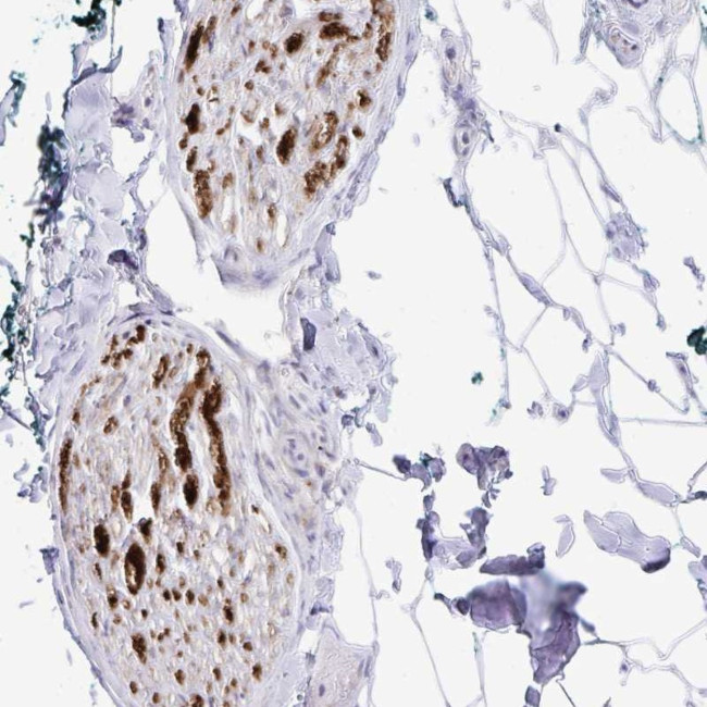 CRG-L2 Antibody in Immunohistochemistry (Paraffin) (IHC (P))