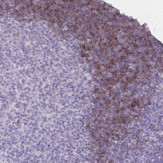 OR4B1 Antibody in Immunohistochemistry (Paraffin) (IHC (P))