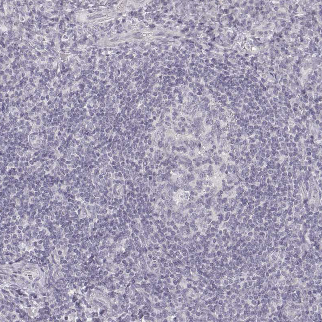 Desmoglein 4 Antibody in Immunohistochemistry (Paraffin) (IHC (P))
