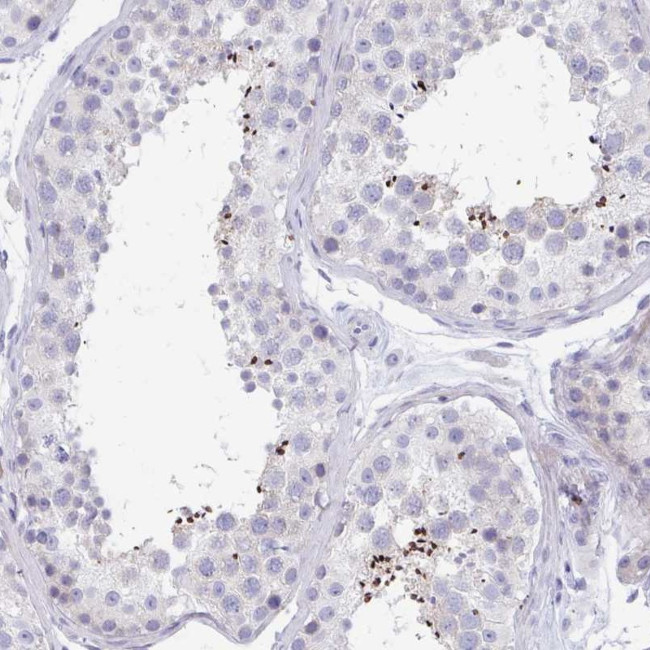 MROH2B Antibody in Immunohistochemistry (Paraffin) (IHC (P))
