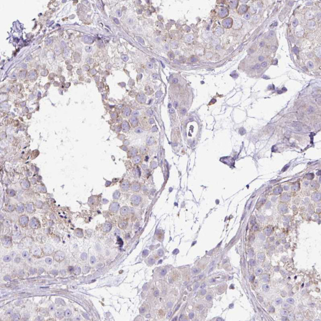 OR4P4 Antibody in Immunohistochemistry (Paraffin) (IHC (P))