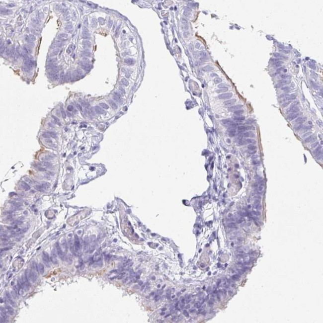 OR5J2 Antibody in Immunohistochemistry (Paraffin) (IHC (P))