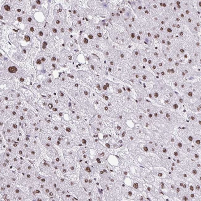 NRBF2 Antibody in Immunohistochemistry (Paraffin) (IHC (P))