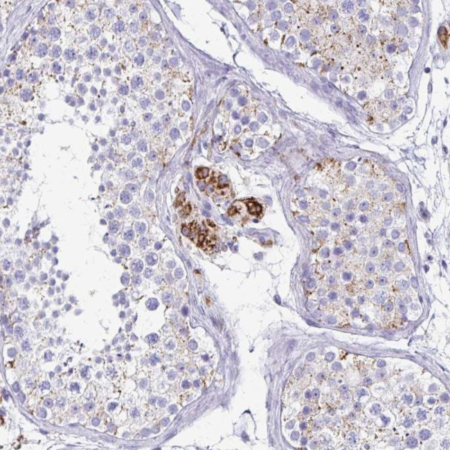 ZSCAN5B Antibody in Immunohistochemistry (Paraffin) (IHC (P))