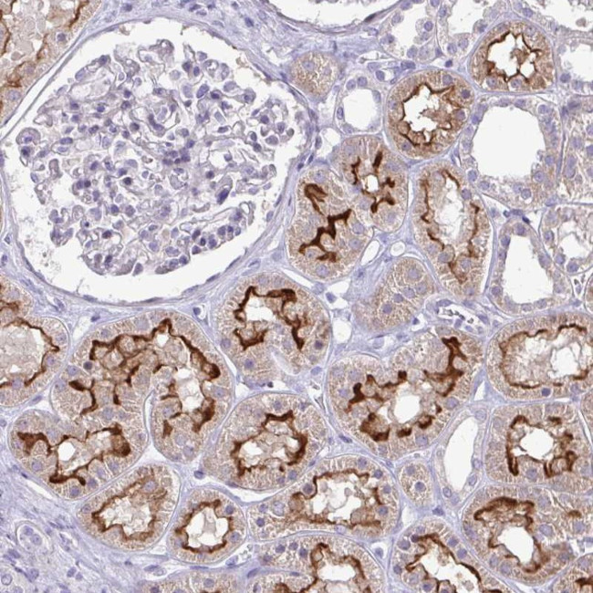 OR8D1 Antibody in Immunohistochemistry (Paraffin) (IHC (P))