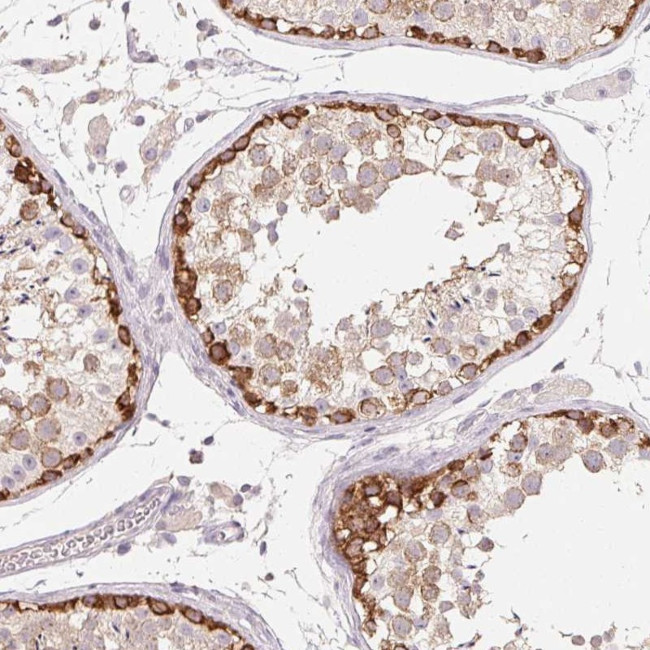 MAP7D2 Antibody in Immunohistochemistry (Paraffin) (IHC (P))
