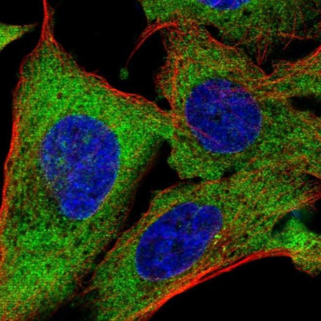 TMEM189 Antibody in Immunocytochemistry (ICC/IF)