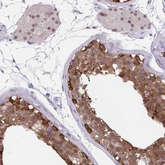 TSN Antibody in Immunohistochemistry (Paraffin) (IHC (P))
