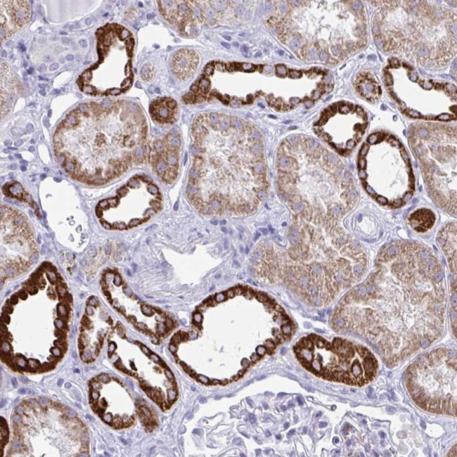 PLA2G12B Antibody in Immunohistochemistry (Paraffin) (IHC (P))