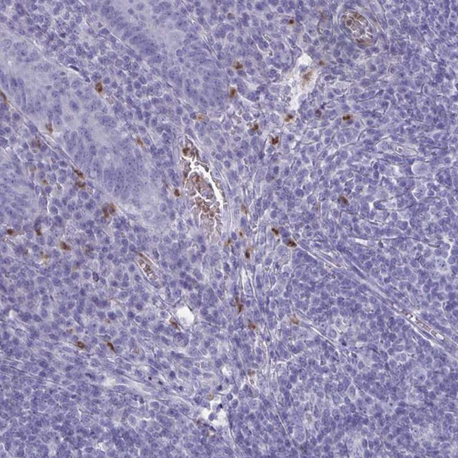 SERPINB10 Antibody in Immunohistochemistry (Paraffin) (IHC (P))
