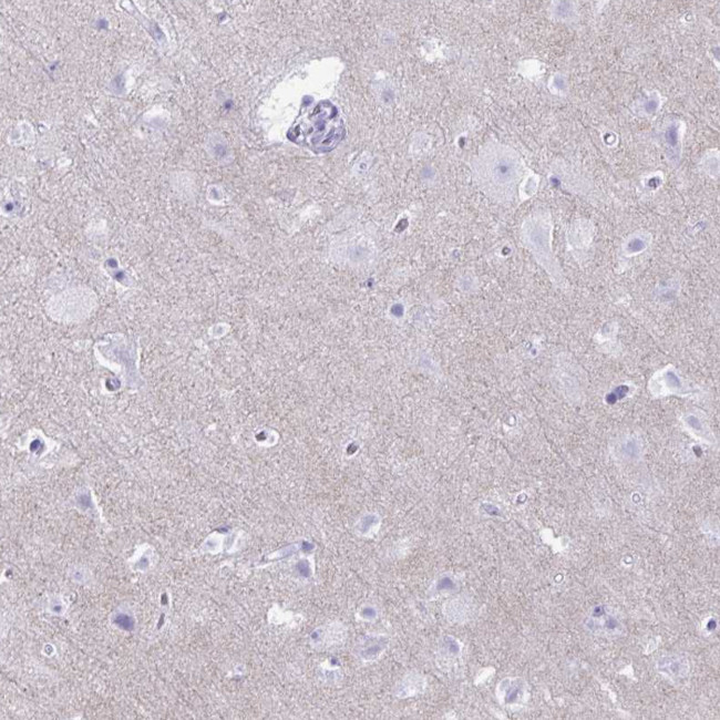 RHBDL3 Antibody in Immunohistochemistry (Paraffin) (IHC (P))
