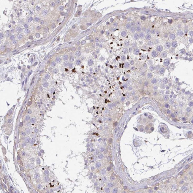 C19orf54 Antibody in Immunohistochemistry (Paraffin) (IHC (P))