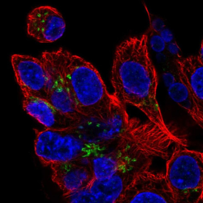 ZDHHC7 Antibody in Immunocytochemistry (ICC/IF)