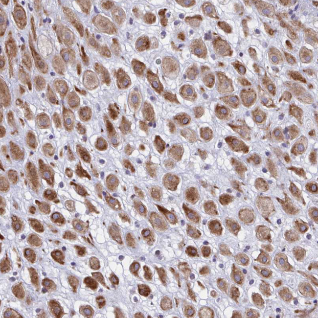 DCBLD1 Antibody in Immunohistochemistry (Paraffin) (IHC (P))