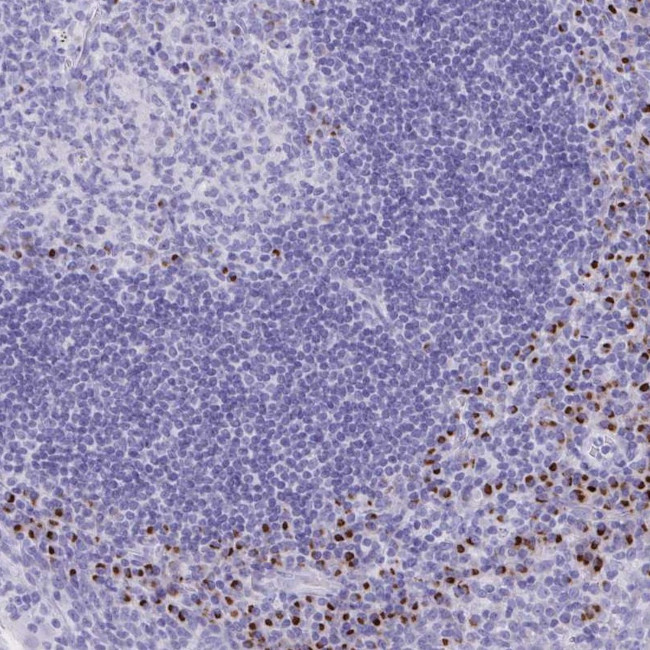 ANKDD1B Antibody in Immunohistochemistry (Paraffin) (IHC (P))