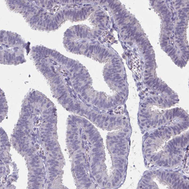 OR4A47 Antibody in Immunohistochemistry (Paraffin) (IHC (P))