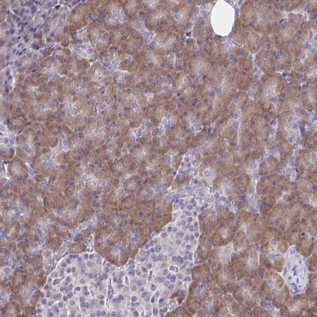 TM41A Antibody in Immunohistochemistry (Paraffin) (IHC (P))