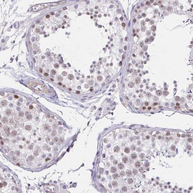 ANKRD62 Antibody in Immunohistochemistry (IHC)