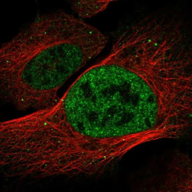 DISP2 Antibody in Immunocytochemistry (ICC/IF)