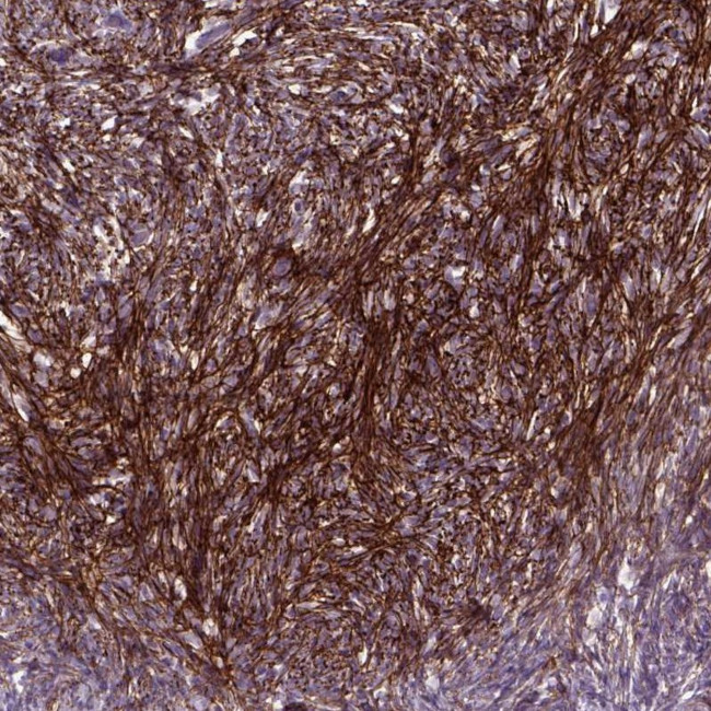 EMILIN3 Antibody in Immunohistochemistry (Paraffin) (IHC (P))
