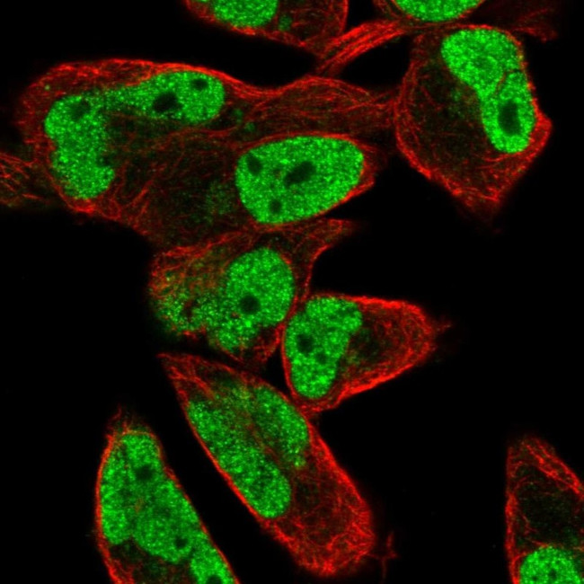FEM1C Antibody in Immunocytochemistry (ICC/IF)
